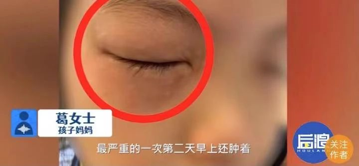9岁女孩做数学题时眼痛肿胀的原因分析