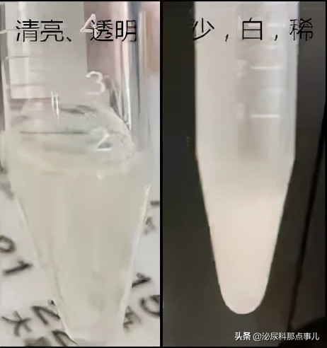 妊娠失败的男性因素有哪些？