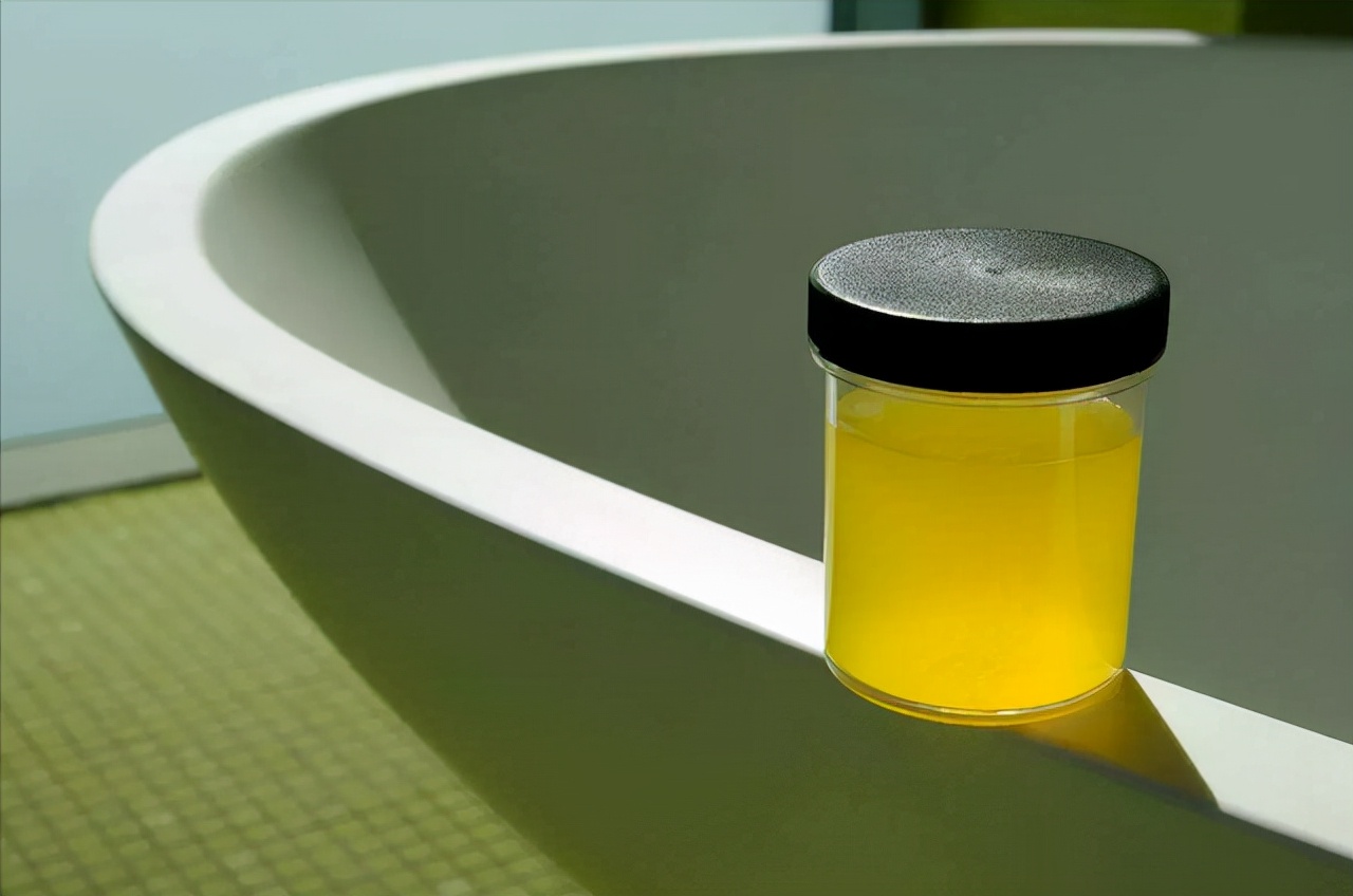 上厕所时，若发现尿液发黄还有异味，是怎么回事？不妨参考下