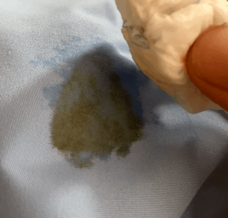 衣服弄脏不要慌，5种难洗污渍的应急处理手法来了（建议收藏）