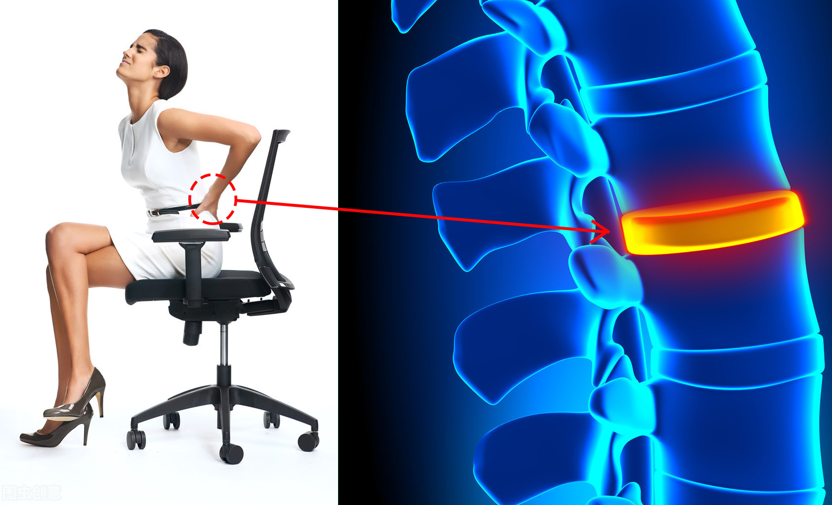 6个缓解腰椎间盘突出的伸展运动，避免7个训练，强壮腰椎不踩雷