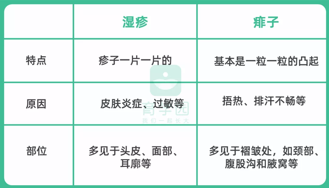 爽身粉、花露水不治痱子！治痱子记住这14个就够了，别乱抹东西