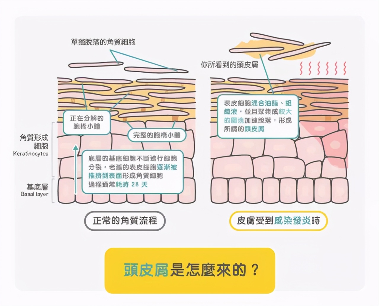 想跟头屑说再见，去屑洗发水就该这样选