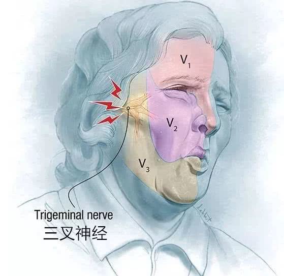 拔牙后剧烈疼痛怎么办？厦门男子拔6颗牙后疼痛难忍