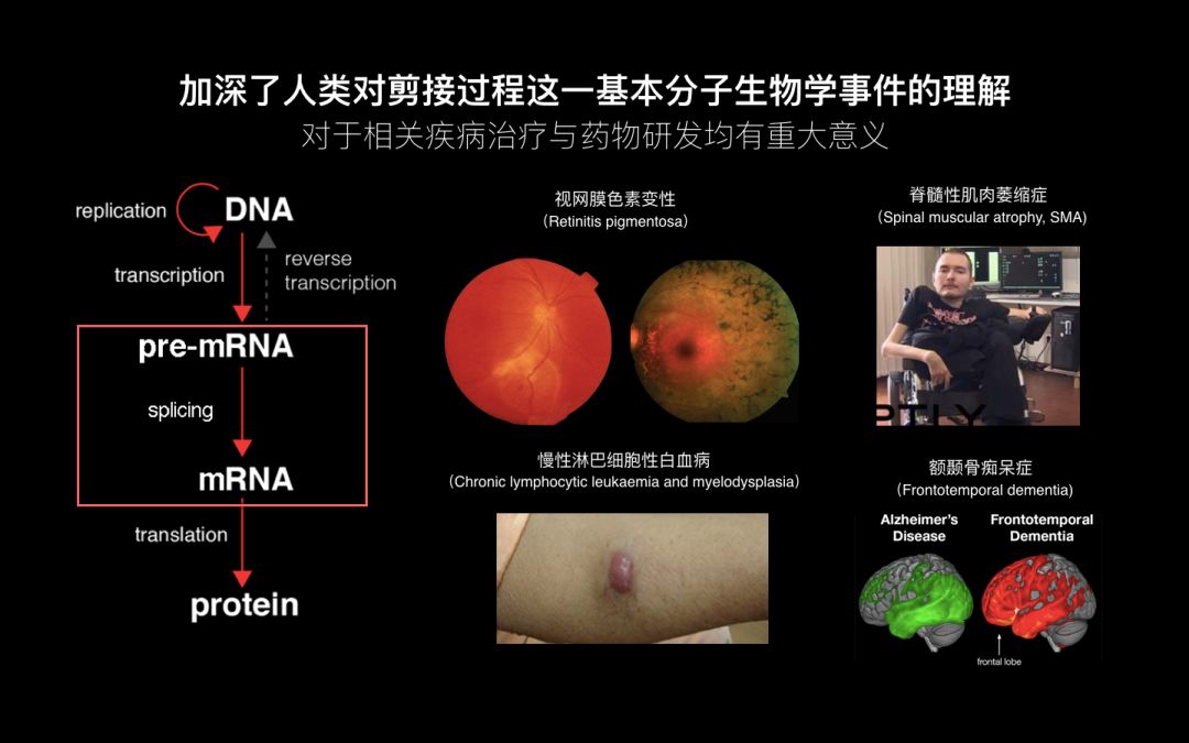 未来女科学家万蕊雪：生命的奥秘和宇宙的奥秘，都是很重要的事情