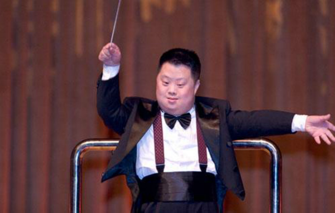 为啥"唐氏儿"都长着同一张脸?医生一般不说,父母最好要知道