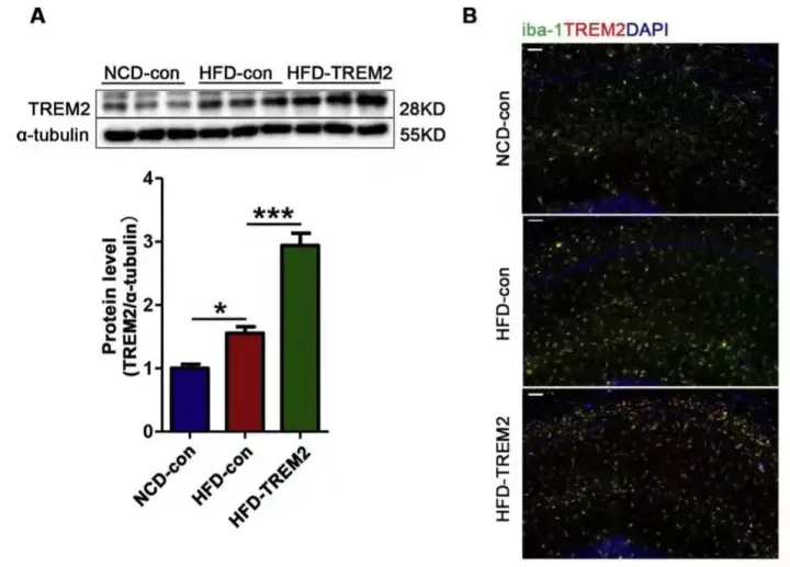 神经领域中「特异性启动子AAV」的妙用