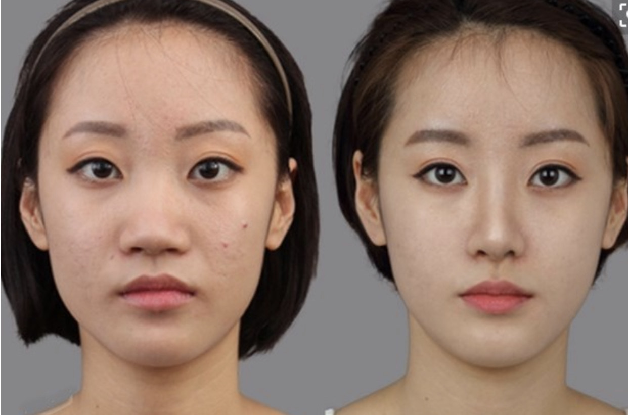 山根是哪个部位(直男眼中的4个"丑鼻型",女生一个都不要占,严重拉低