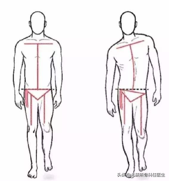 孩子臀纹不对称，看完门诊还是不明白？一次性解答你所有问题