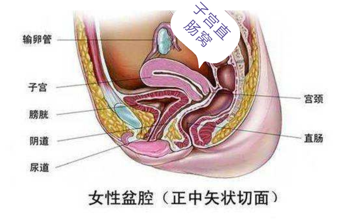 女性之痛：不是每一种积液都是病，这种情况不用打针吃药