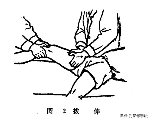 掌握了这8种正骨接骨手法，遇到骨折伤痛都可以轻松调理