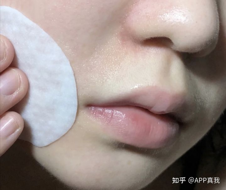 怎么才能消除闭口粉刺？看这里