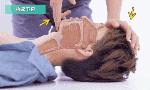 几乎每分钟都有人因它死亡，心源性猝死该如何抢救？