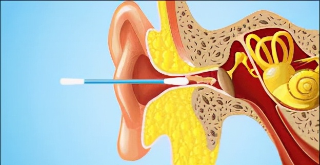 用棉签给宝宝掏耳朵吗？妈妈错误的掏耳方式，掏丢的只有健康