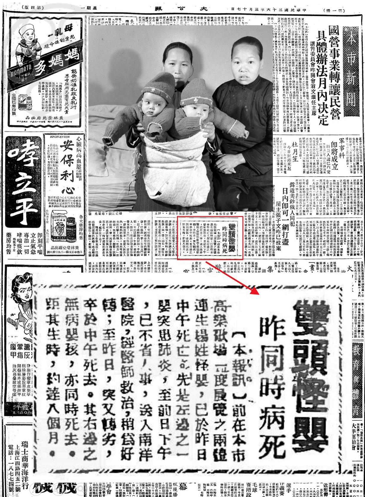 1947年上海老照片，“连体婴儿”展览事件始末