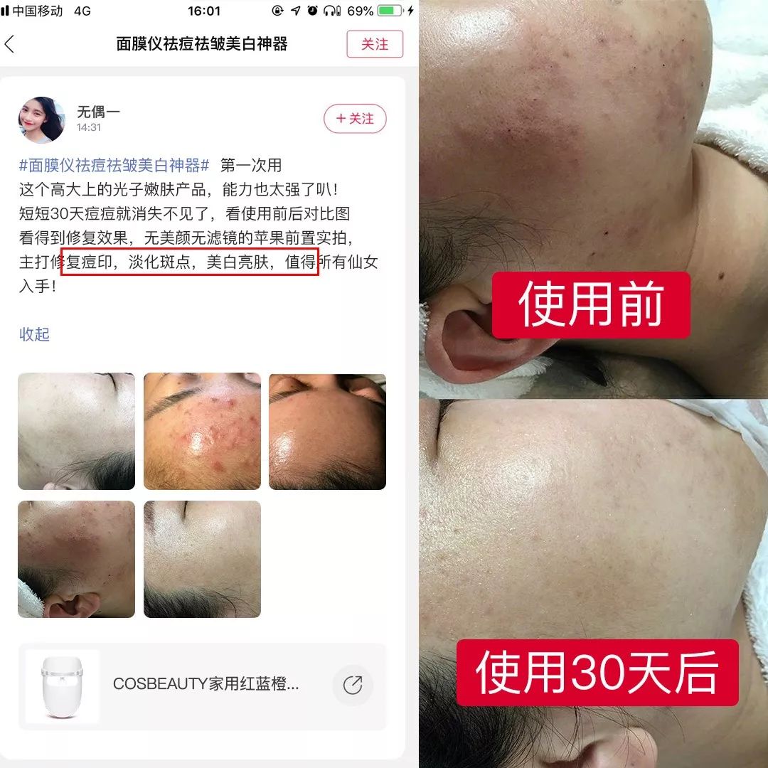 美容院光子嫩肤贼贵?却不知李湘、张檬、黄圣依都在用的美容仪