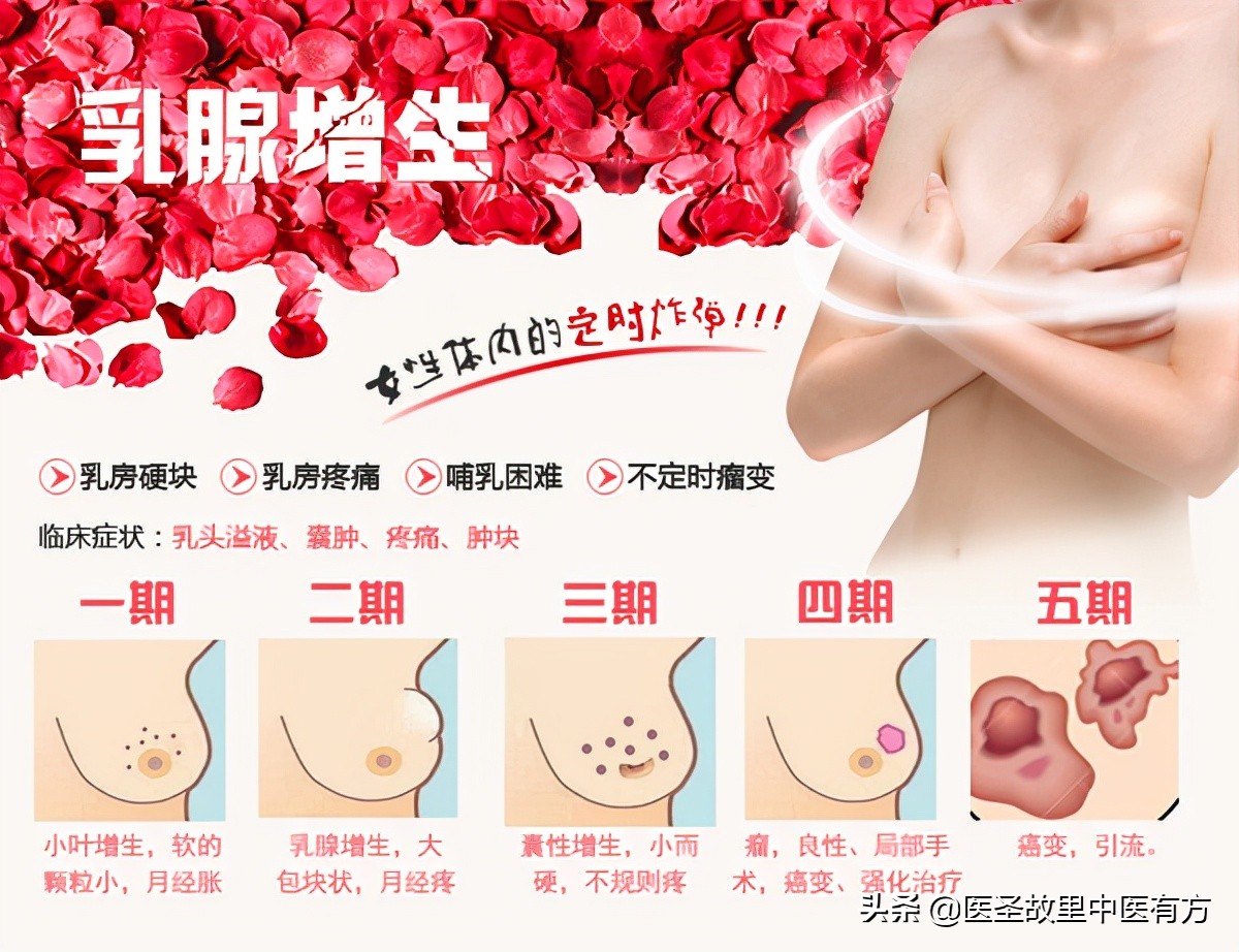 老中医总结：史上最全治疗乳腺增生、乳腺结节的中成药，建议收藏