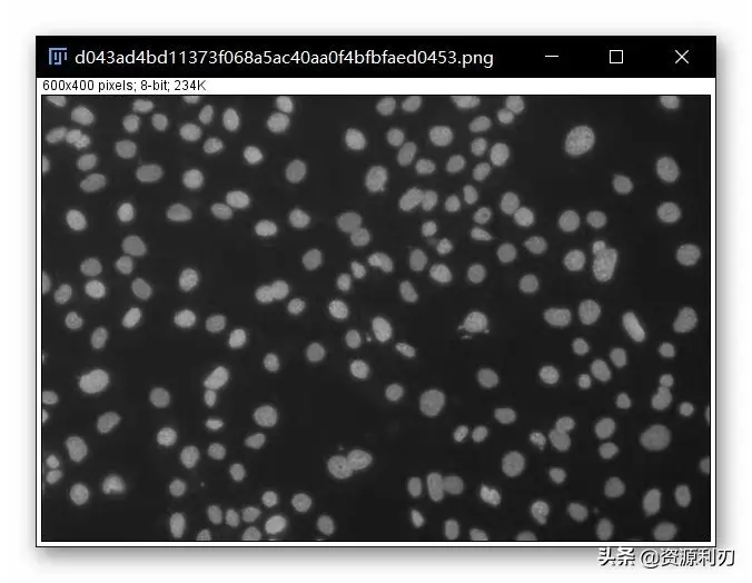 imagej细胞计数步骤（怎么用ImageJ进行自动细胞计数）