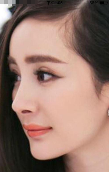 鹰钩鼻是畸形鼻鹰钩鼻是畸形鼻吗