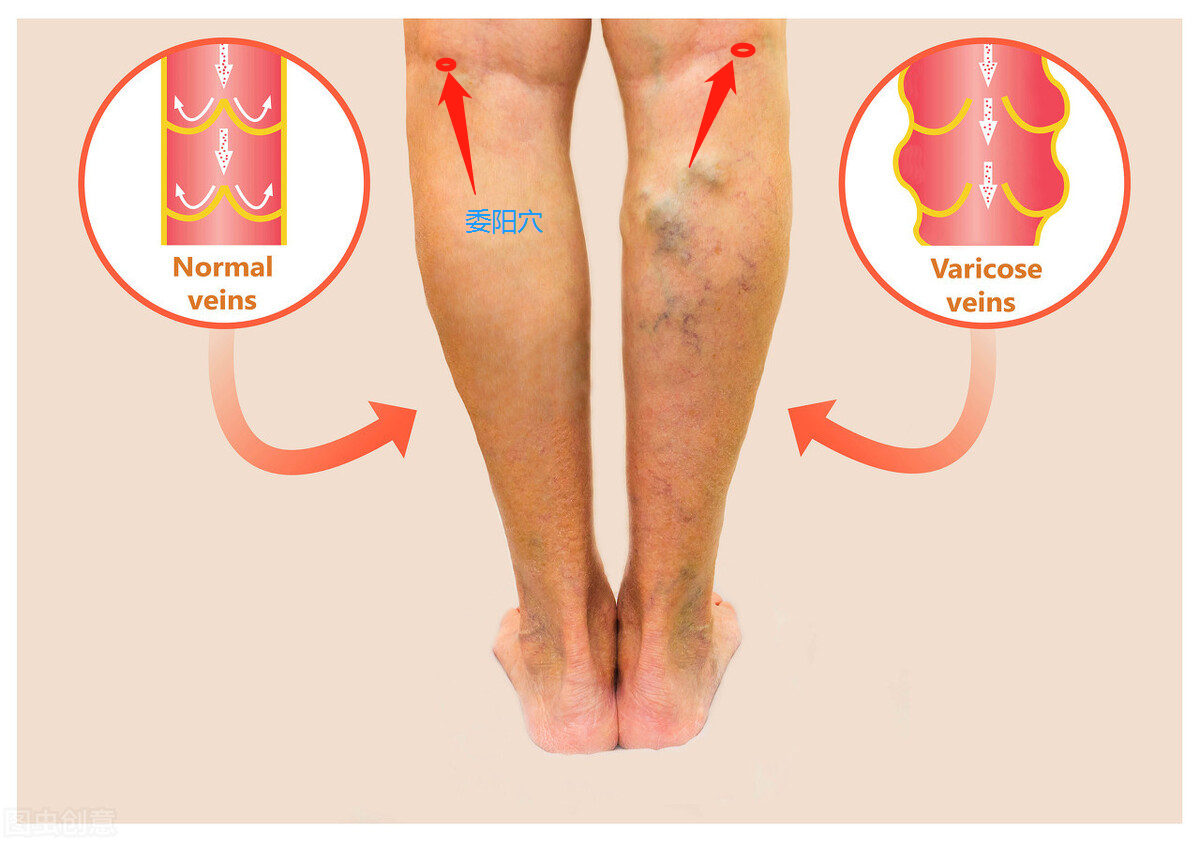 委阳穴小腿后侧疼痛的要穴三焦经的下合穴通达三焦气机之功