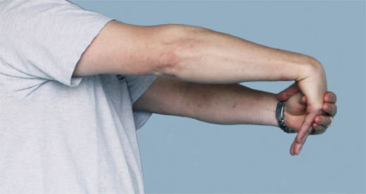 网球肘的症状位置图片(胳膊肘疼不能提重物拧毛巾) - 赤虎壹号