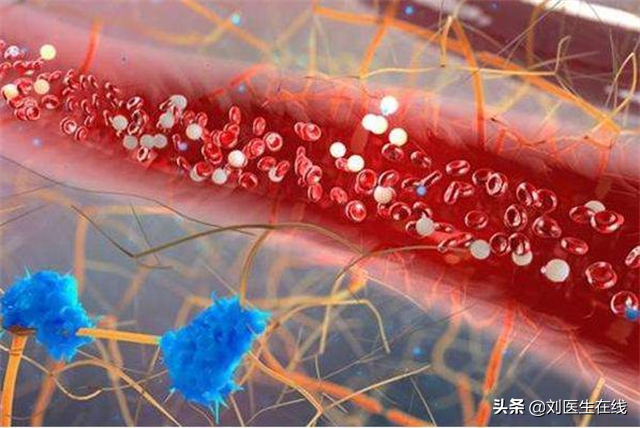 低密度脂蛋白偏高怎么回事