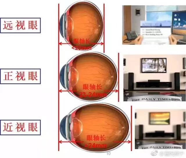 眼镜结构是怎样的（关于眼镜的组成和细节组成）