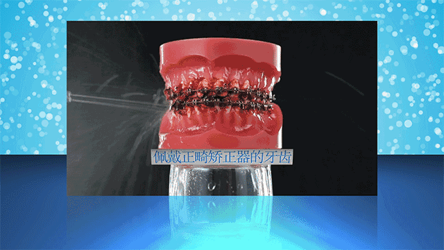牙科拜拜，用它在家也能洗牙，每次不到2毛
