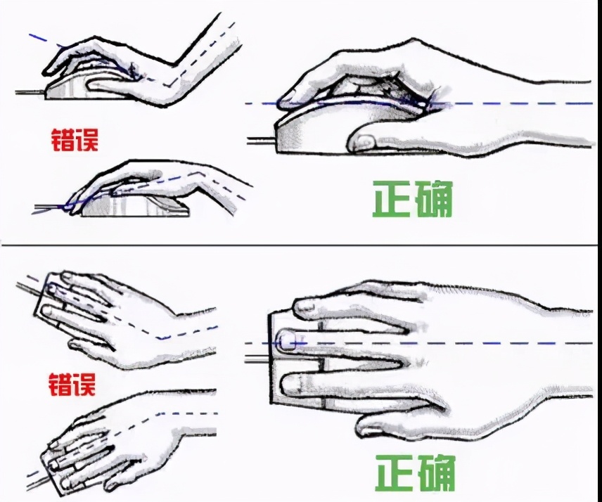 经常手麻绝不是忍一忍就过去了，背后可能有大问题