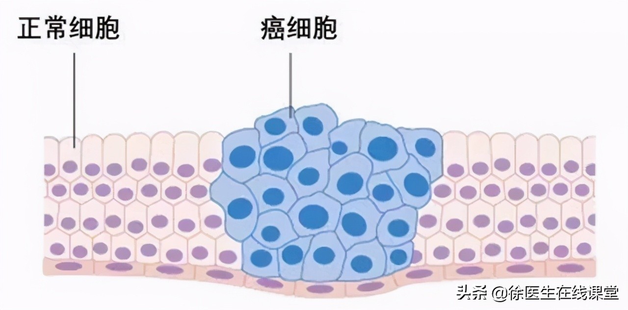 血型真的决定寿命？A型、B型、AB型、O型，哪种血型更长寿？