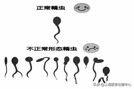 试管助孕不仅女性需要注意年龄，男性也同样重要