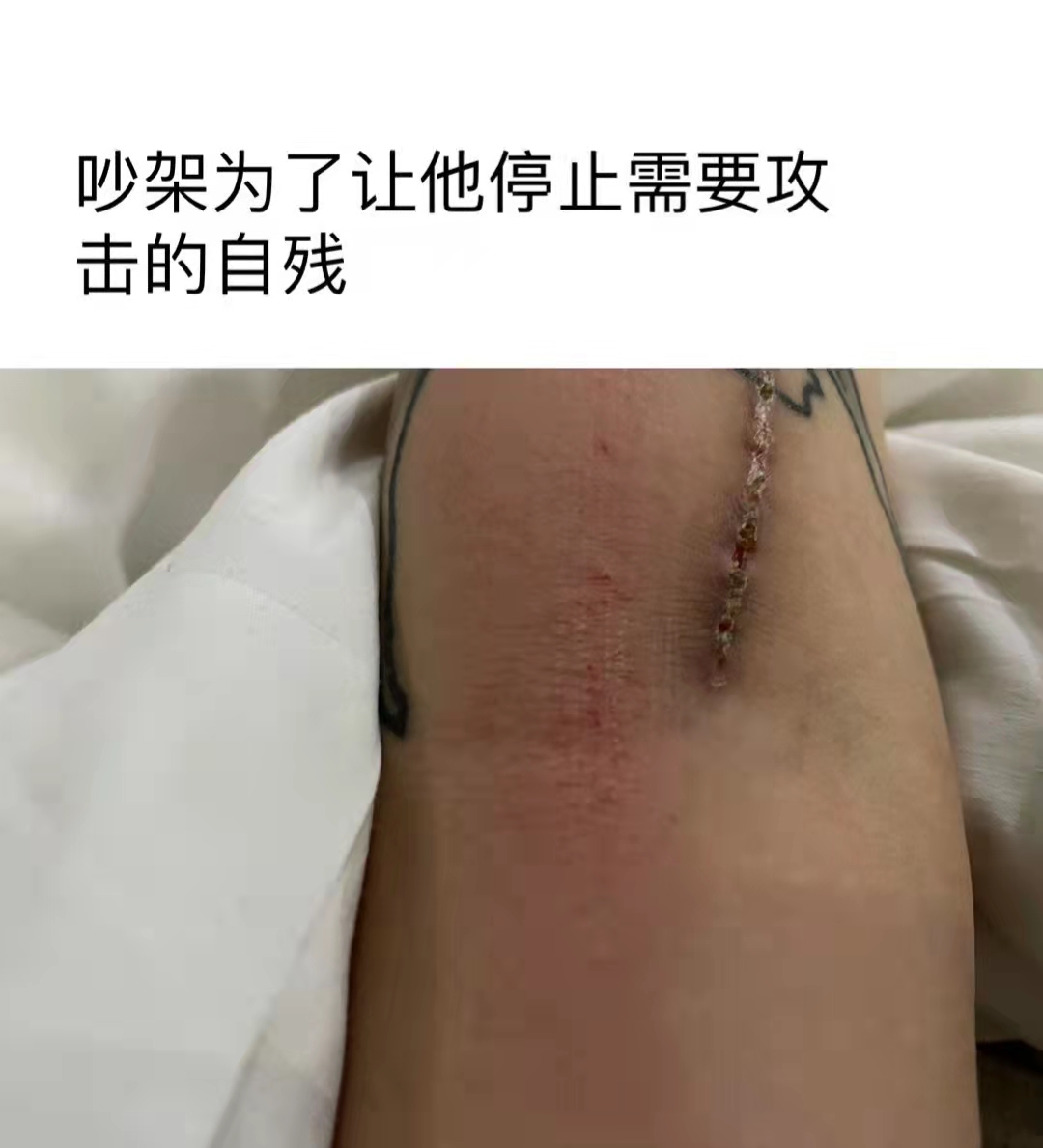 割大腿自残的图片图片