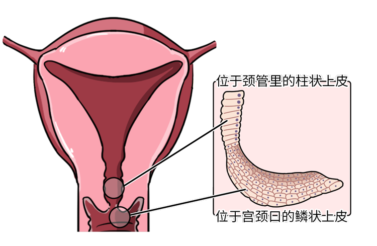 女性须知：体检发现5种妇科病，不要乱治！花了冤枉钱还伤身体