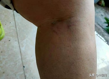 殴打老人,殴打老人该如何处罚