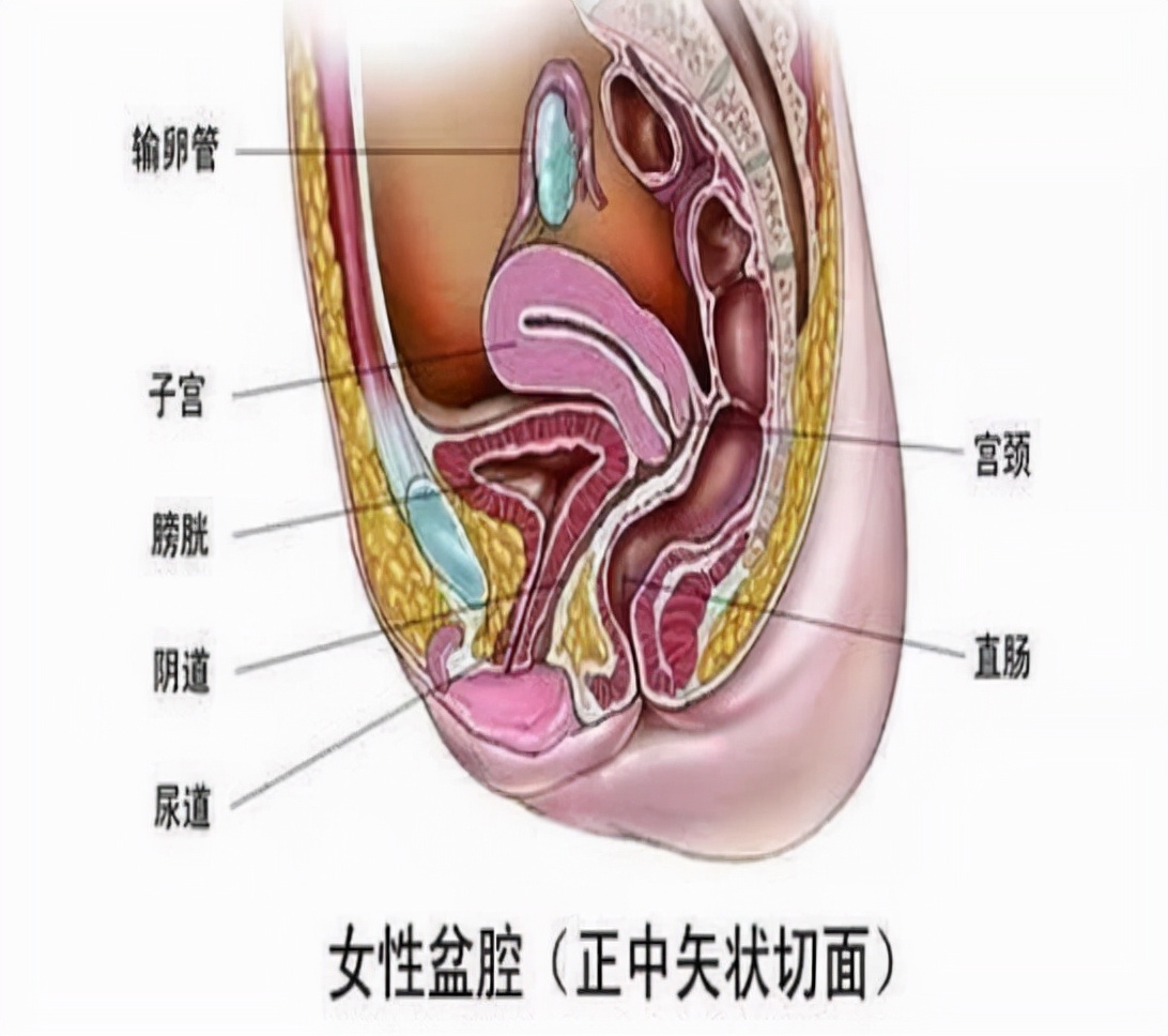 盆腔积液的位置图片图片