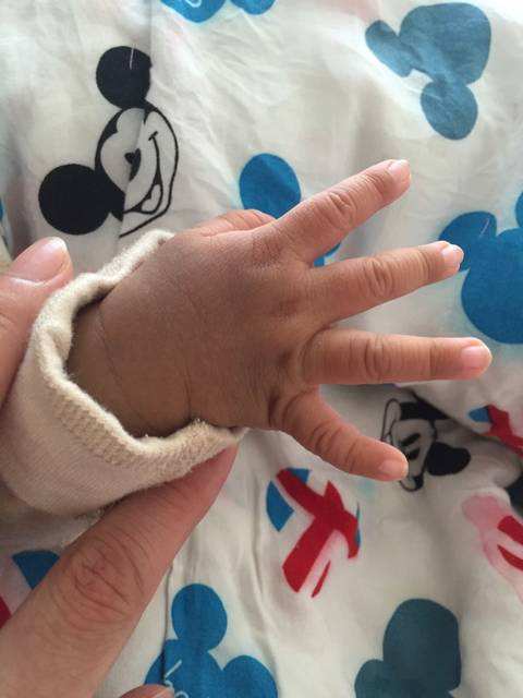 辟谣,孩子的马牙要挑?别瞎处理,新生儿这9种情况都是正常的