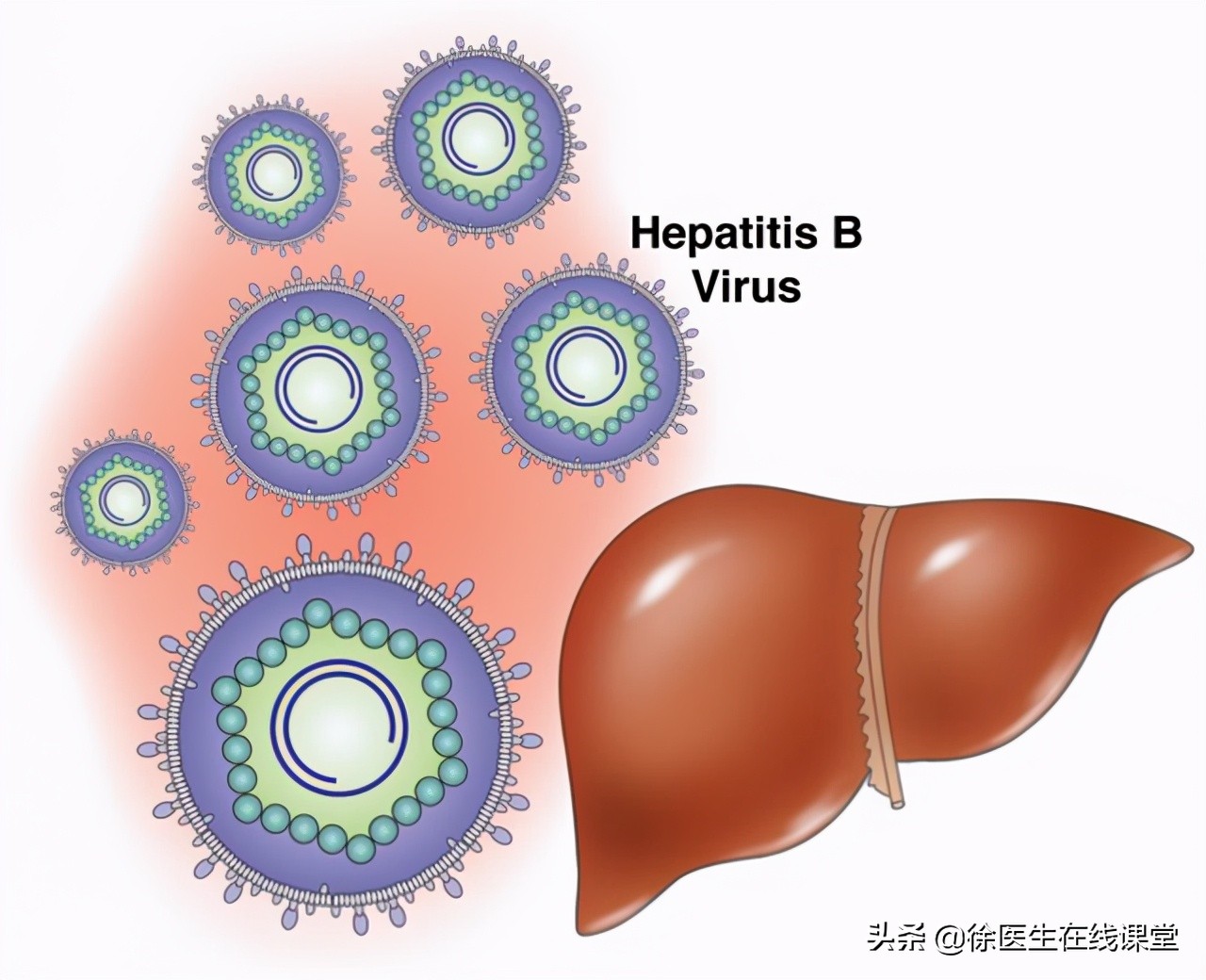 乙肝严不严重，不是看表面抗原和病毒DNA，这些检查你得了解