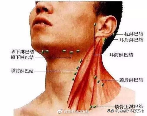 颈部淋巴结肿大,正常现象还是癌症转移?