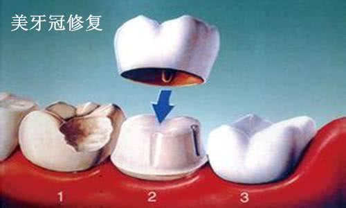 作为一个牙科医生，我必须要告诉所有人一个牙齿真相！