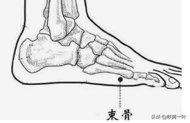 关节炎的辩证针灸，风寒湿痹的辩证论治。