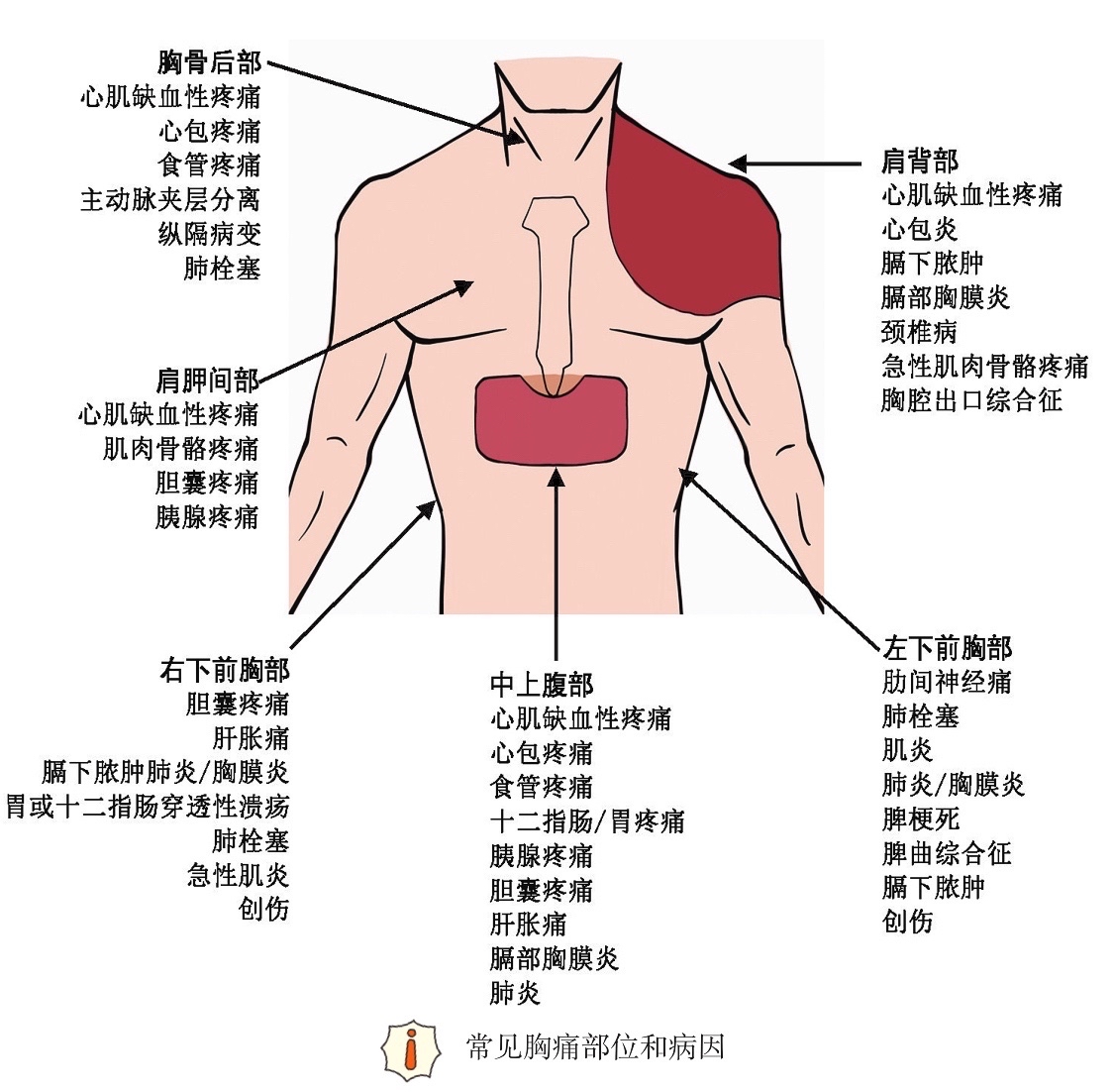 胸痛不只和心脏有关，有些原因更加凶险