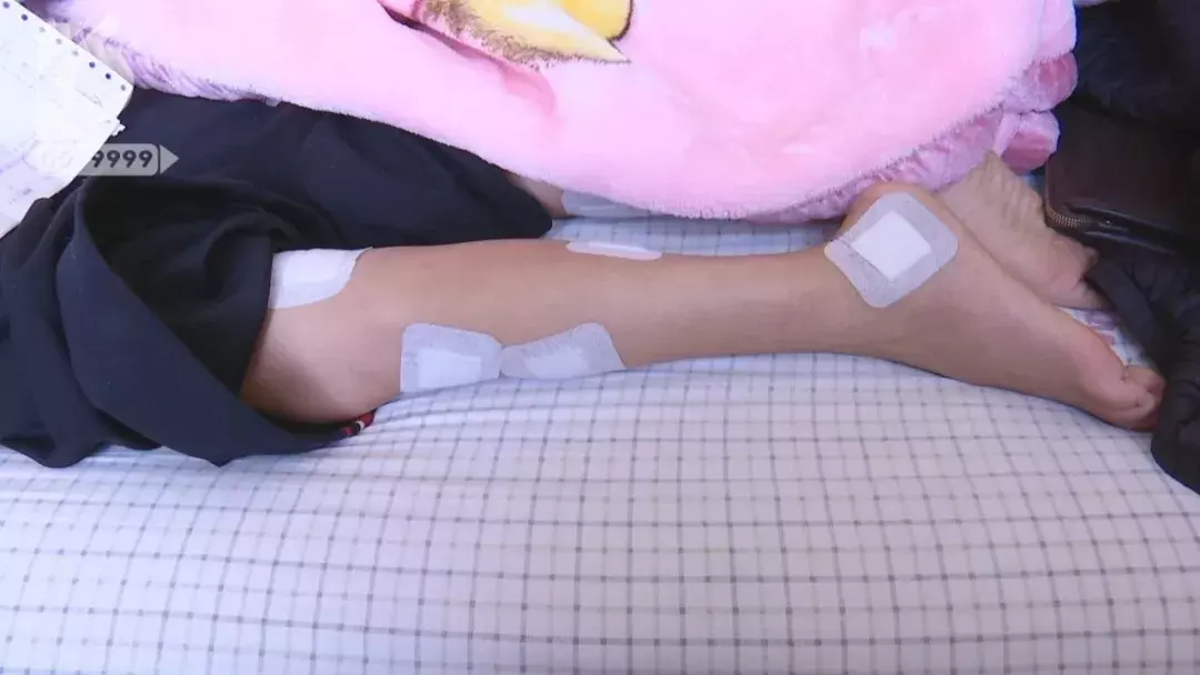 服务费,我们水都没喝他们的一口,怎么叫生活服务,这个手术费是打银针