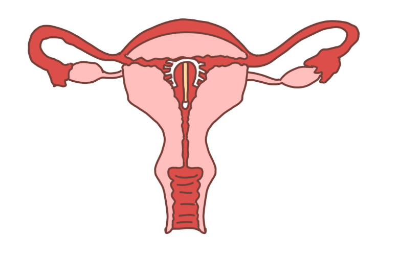 身体总是出现问题,但不敢取下节育环在上环之前,医生都会进行相应的