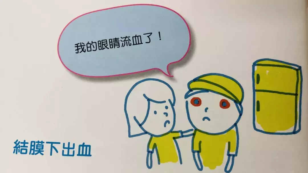 有一种眼出血看起来很吓人，其实没有危险