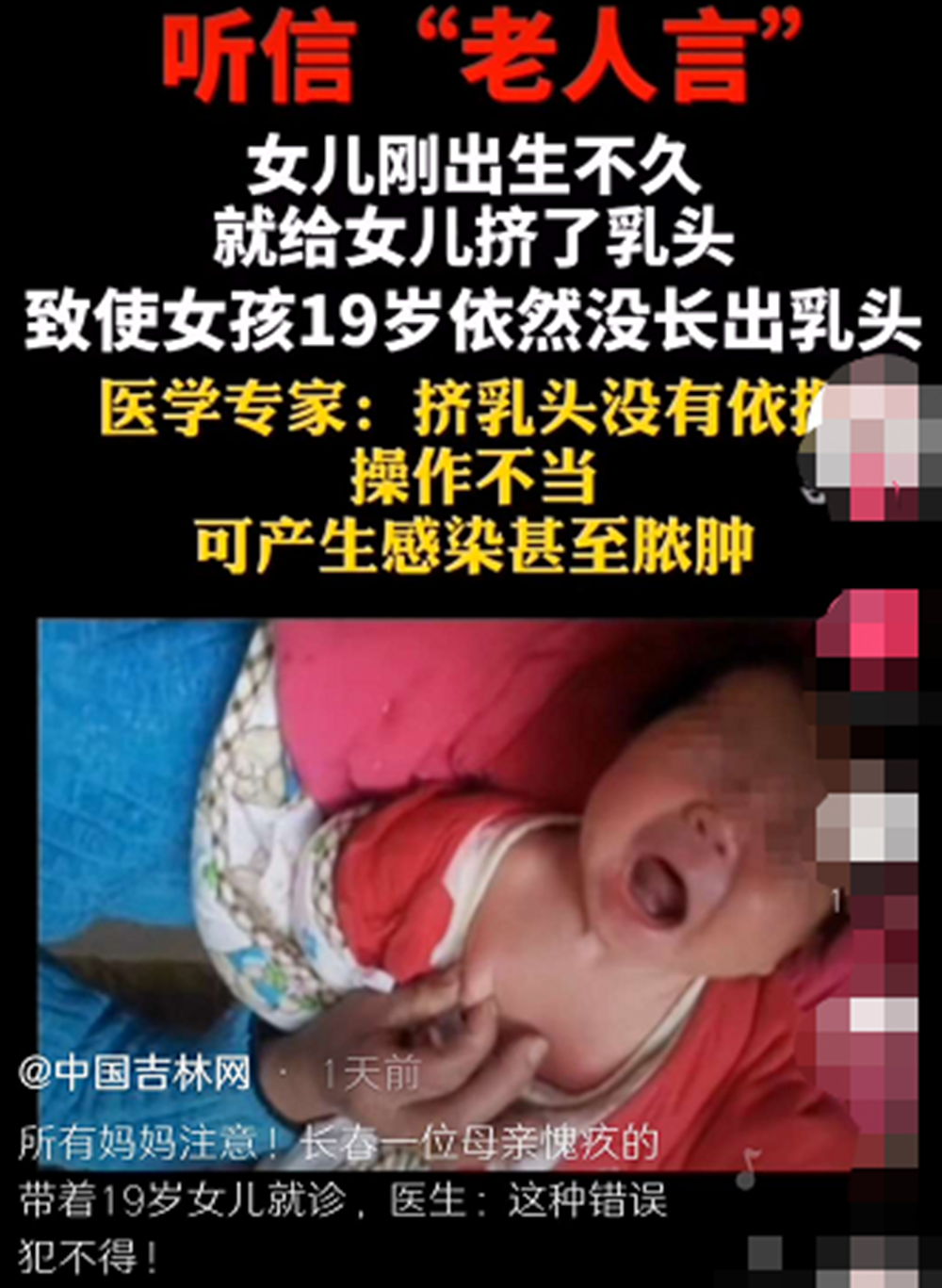 辟谣，乳头凹陷不能母乳喂养？只需三招让宝宝喝上营养香甜的母乳