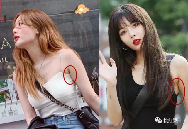 包裹起来,而溢到腋下等其他区域,导致组织变形外扩,从而形成腋下副乳