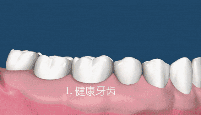 医生，我的牙龈萎缩了，能再恢复吗？