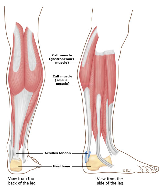 跑步运动后小腿脚后跟疼？骨科医生告诉你：「跟腱炎」该如何防治