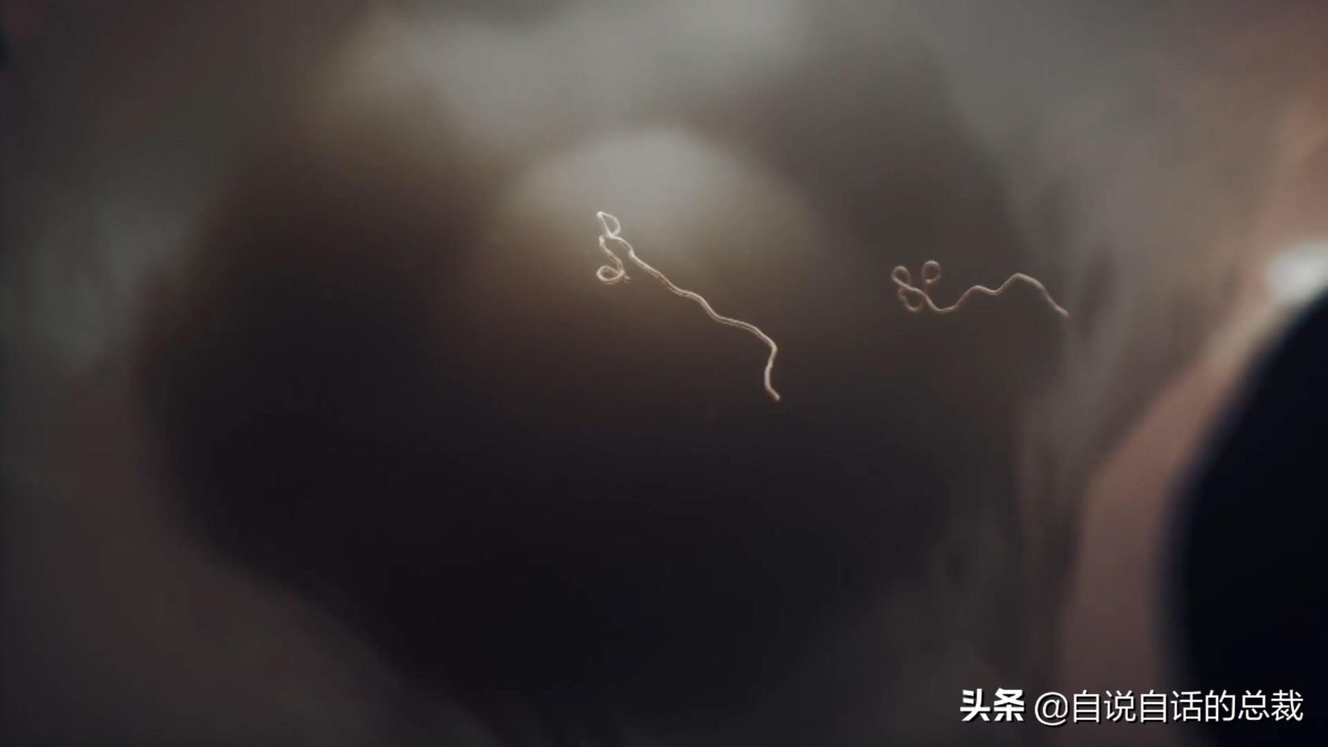 埃博拉：人类的诅咒，你的身体如何对抗它，它到底有多恐怖
