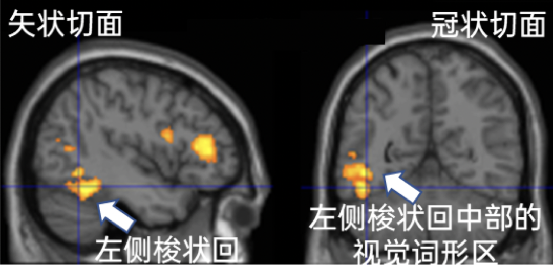 都是看《哈利·波特》，你在刷电影玩游戏，有人发了3篇大脑论文